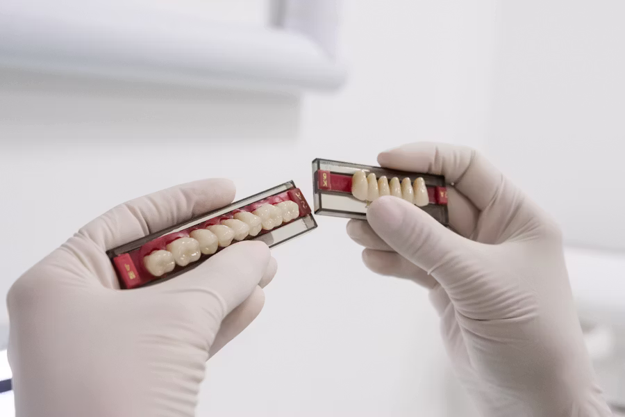 Cura dell'impianto dentale — Odontomedica San Matteo