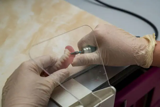 Implantologia — Odontomedica San Matteo
