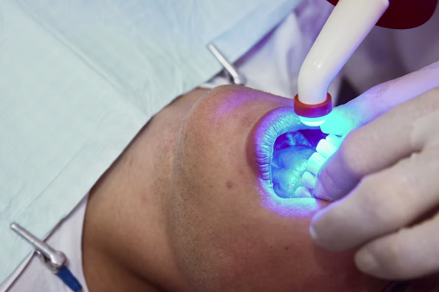 Sbiancamento denti professionale in studio — Odontomedica San Matteo